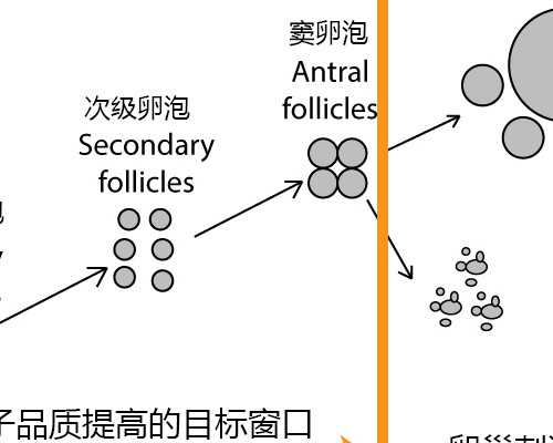 卵巢囊肿不孕